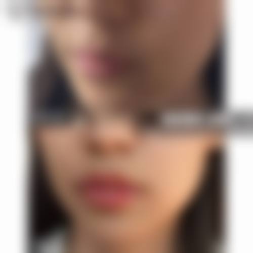 五、哈尔滨市红十字中 心医院价格表