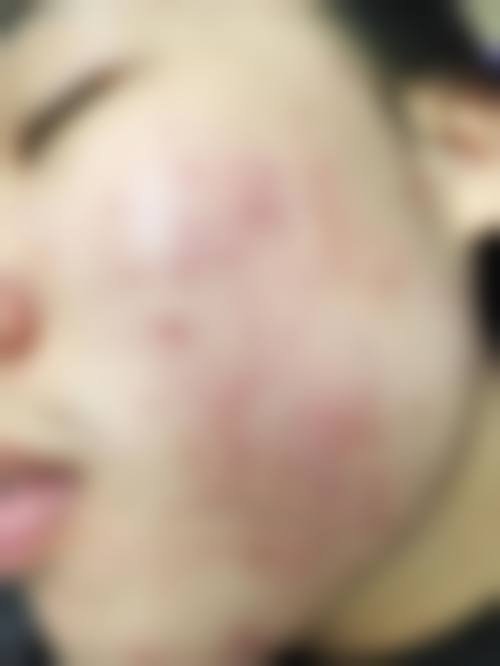 四、哈尔滨市红十字中 心医院特色项目