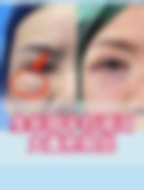 三、厦门湖里今昔悦己整形医院诊疗项目有哪些?