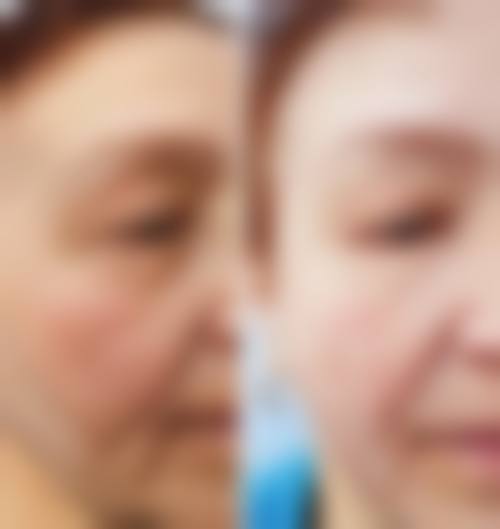 四、南京在水整形医院特色项目