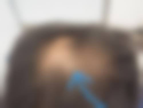 九、包头五维尚美整形医院真实的患者评价