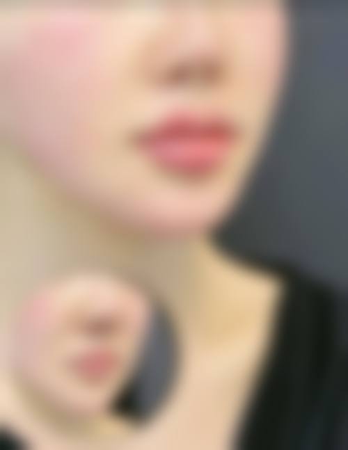 八、上海纽顿整形医疗美容门诊部真实的患者评价