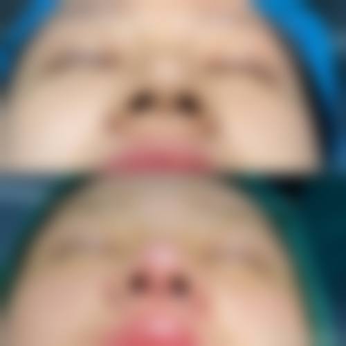 四、安徽合肥未莱植发特色项目