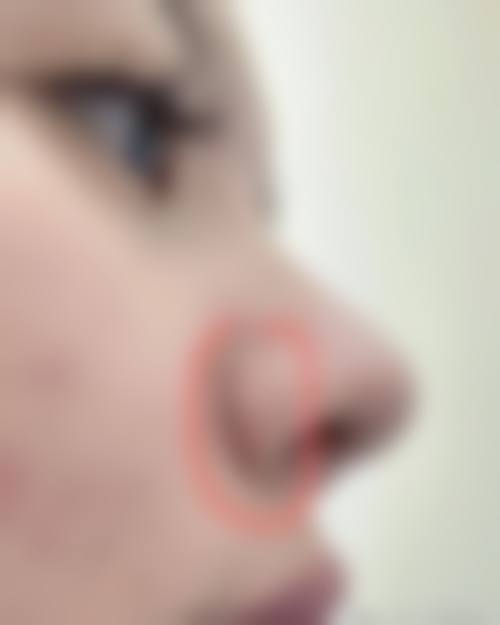 四、哈尔滨市南岗区医 大医美医疗美容门诊部特色项目