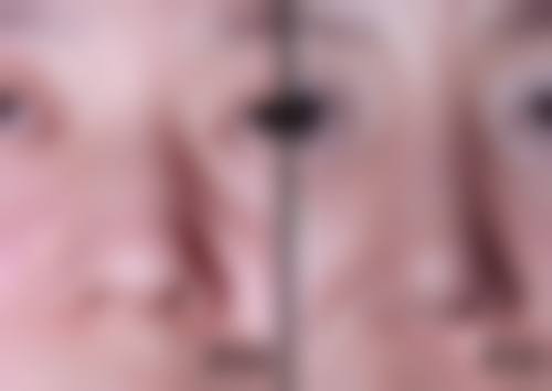 二、玉溪左医生医疗美容门诊部怎么样？