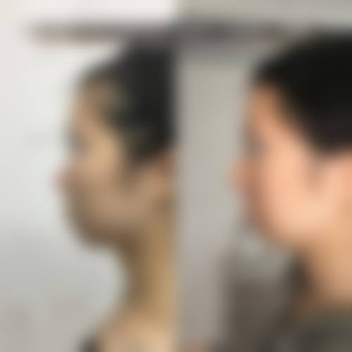 四、包头五维尚美整形医院特色项目