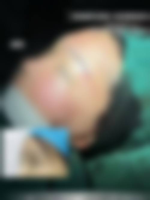 四、玉溪左医生医疗美容门诊部特色项目