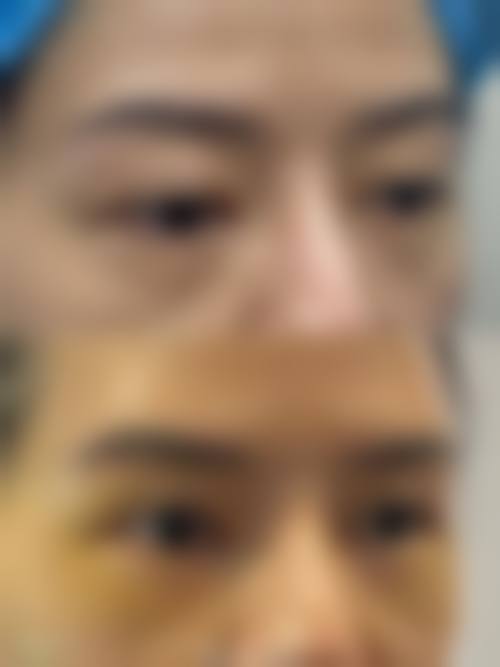 九、玉溪左医生医疗美容门诊部真实的患者评价