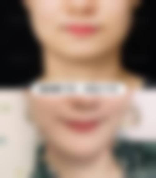 九、苏州温家岸美容门诊真实的患者评价