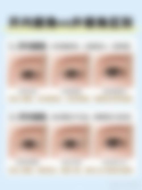 四、宁波华爱医疗美容门诊部特色项目