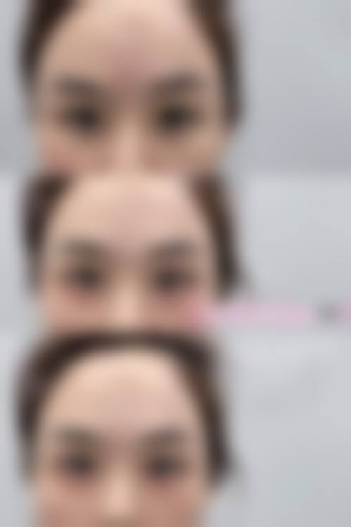 八、宁波华爱医疗美容门诊部真实的患者评价