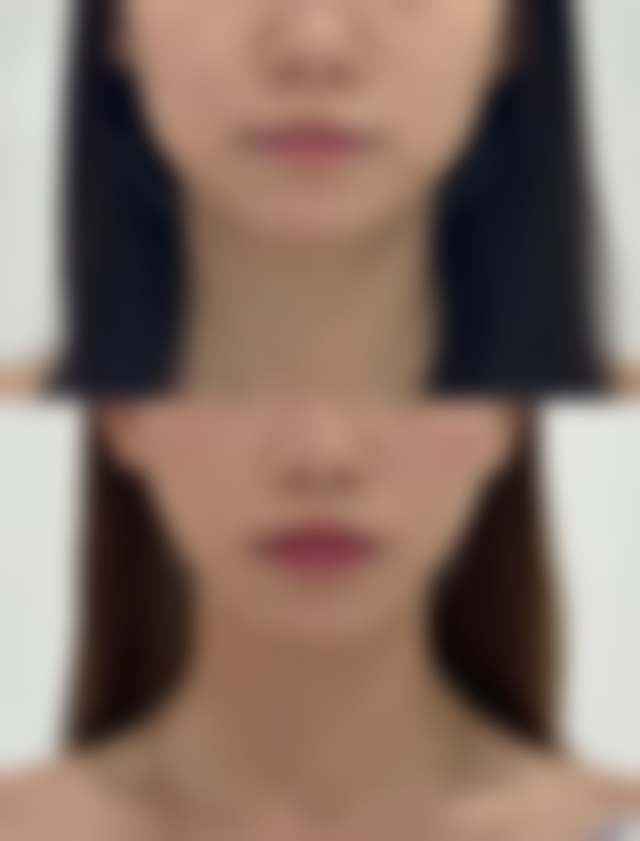 三、包头五维尚美整形医院诊疗项目有哪些？