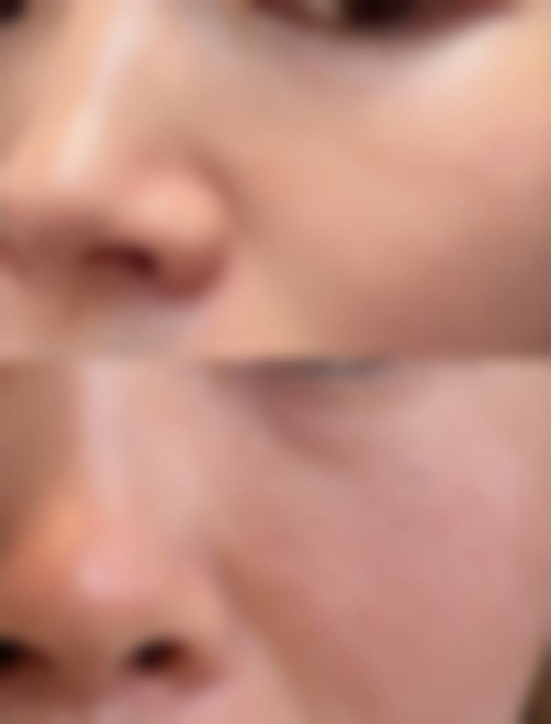 三、日常护理方法