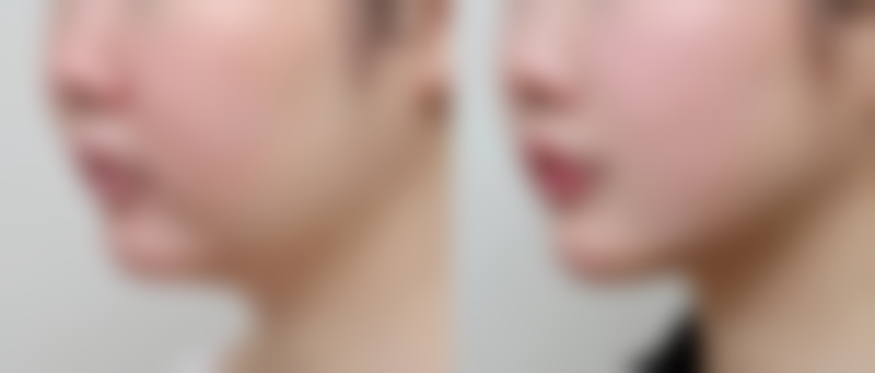 五、朱小慧怎么预约？