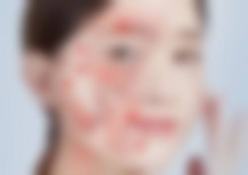 二、亳州市人民烧伤整形科怎么样？