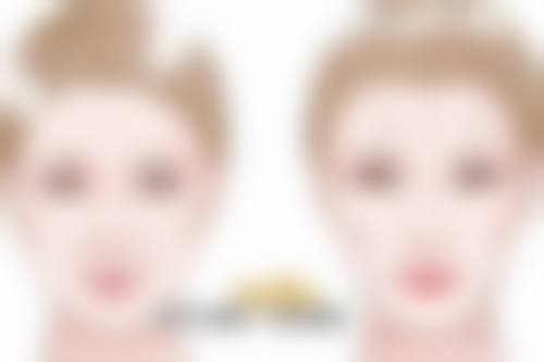 一、了解双眼皮手术及吃辣影响