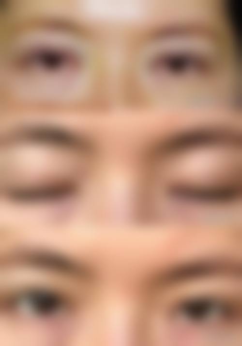 八、韩国格林整形医院真实的患者评价