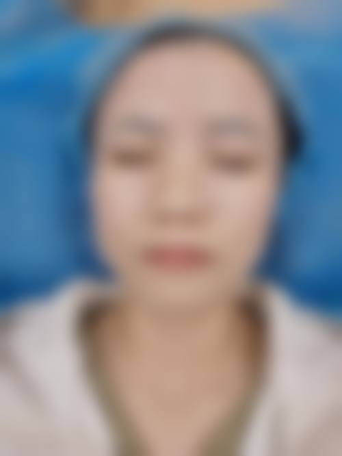 二、韩国格林整形医院怎么样?