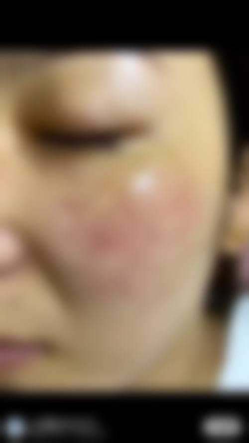 四、唐山京顺整形美容医院特色项目