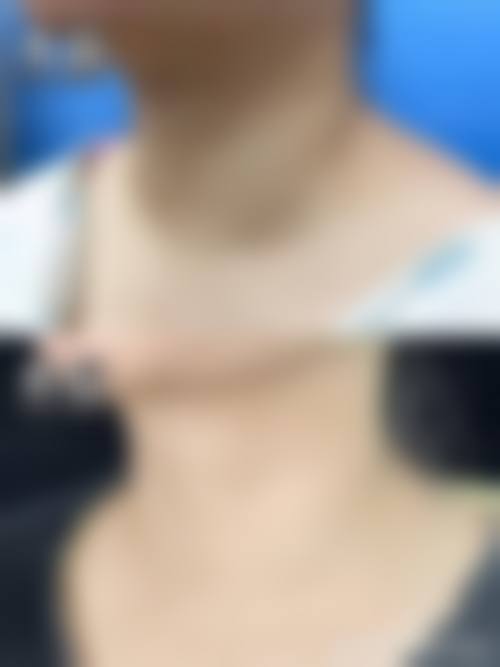 八、无锡爱思特整形美容医院真实的患者评价