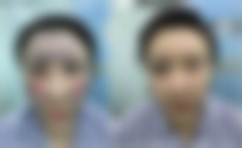 六、亳州市人民烧伤整形科价格表