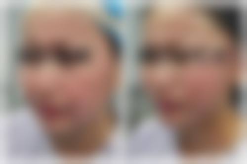 六、北京欧扬医疗美容医院价格表