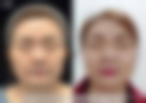 八、北京欧扬医疗美容医院预约方式