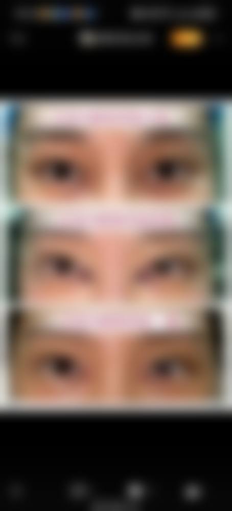 五、无锡爱思特整形美容医院价格表