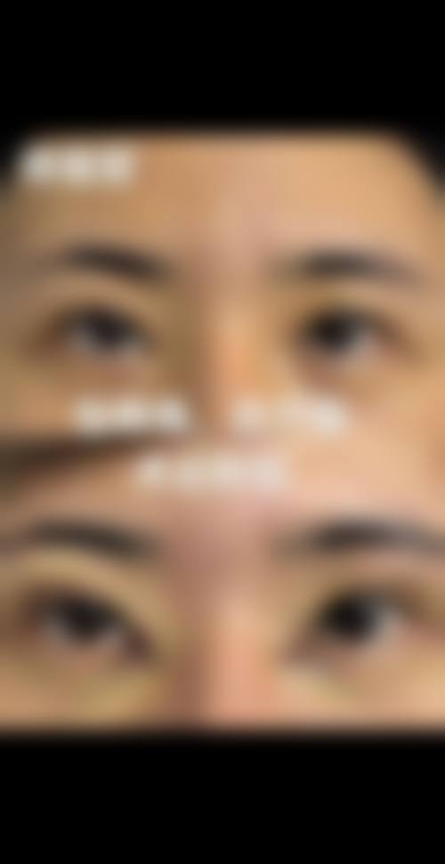 四、无锡爱思特整形美容医院特色项目