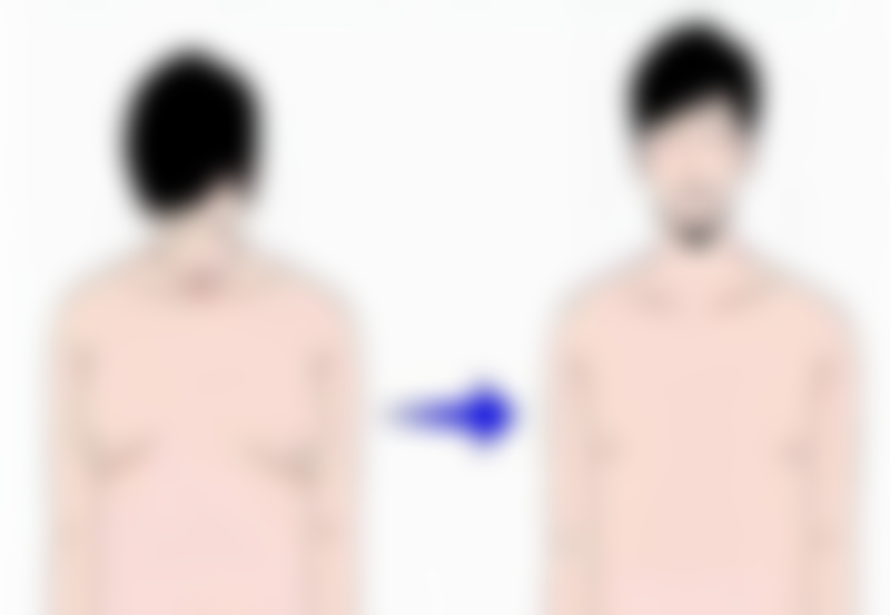 一、溶脂针消除眼袋的原理