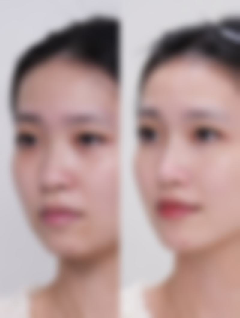 八、日本花园美容整形医院预约方式