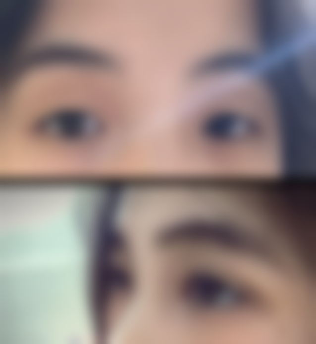 八、黑龙江哈尔滨艺星整形美容医院真实的患者评价