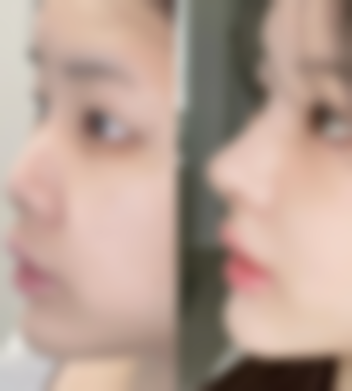 七、韩国格林整形医院预约方式