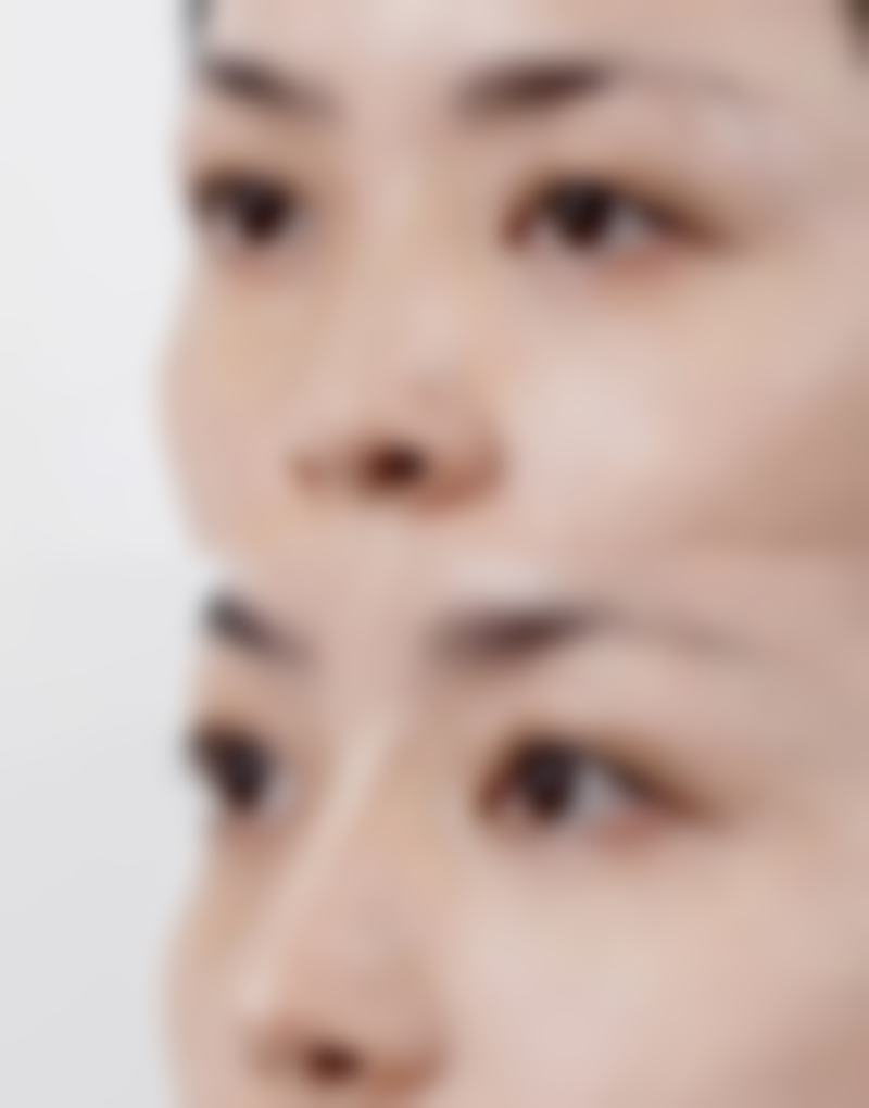 四、怀化天姿整形医疗美容门诊部特色项目