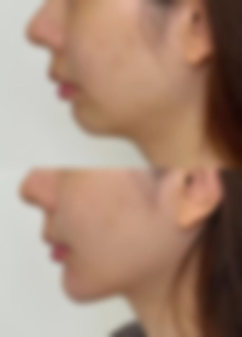 三、韩国格林整形医院诊疗项目有哪些?