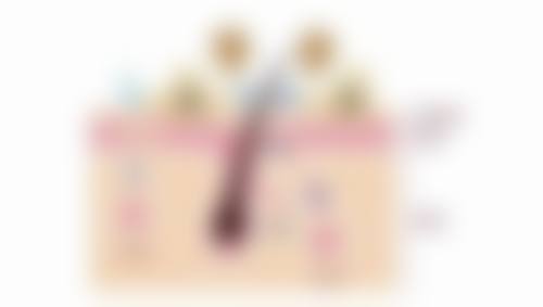 六、眼袋贴一天贴几次比较好——风险提示与护理建议