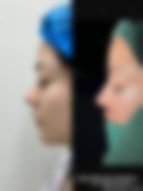 九、象山奈西整形医院真实的患者评价