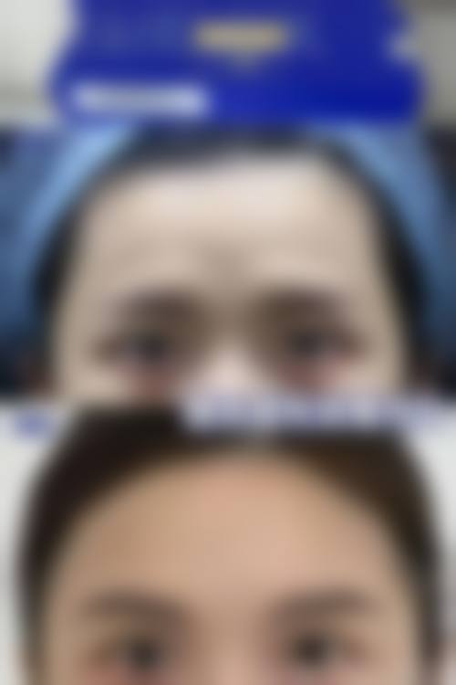 九、呼和浩特华医整形美容真实的患者评价