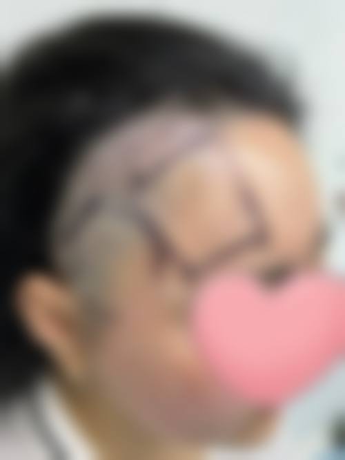 四、呼和浩特华医整形美容特色项目