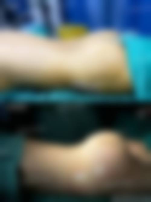 九、苏州心妍美整形医院真实的患者评价