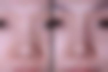 二、南昌美伊尔医疗美容门诊部怎么样?