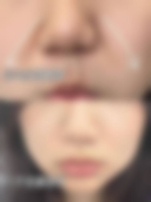 九、银川市艾若整形美容诊所真实的患者评价