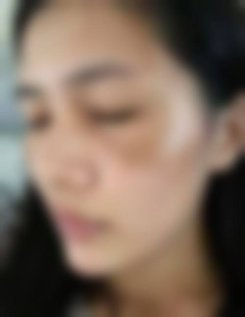 四、银川市艾若整形美容诊所特色项目