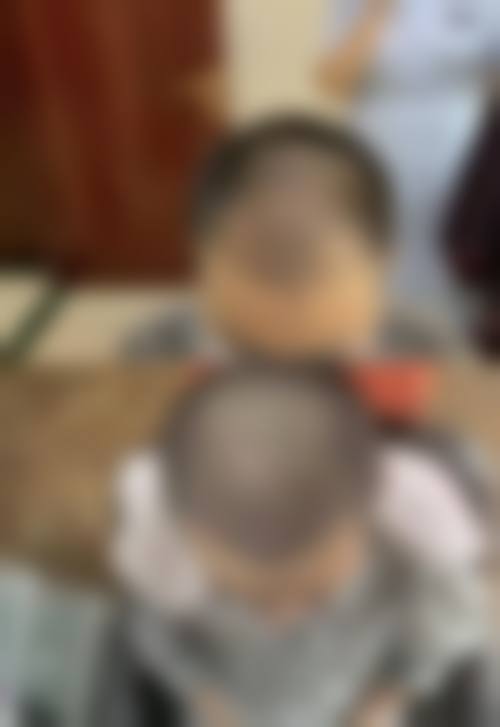 五、成都恒博医院植发价格表