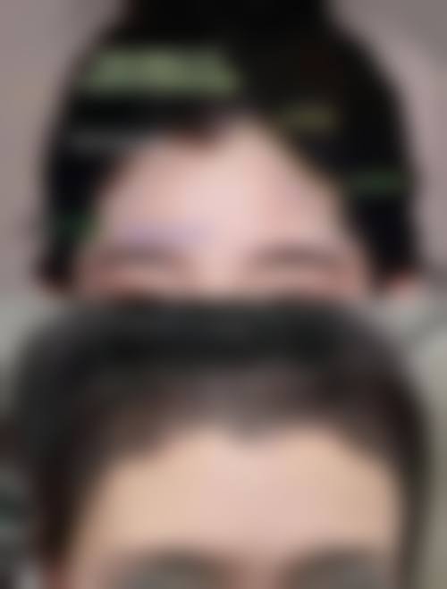 三、成都恒博医院植发诊疗项目有哪些?