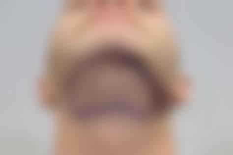 五、汕头大学医学校前列附属医院整形美容外科价格表