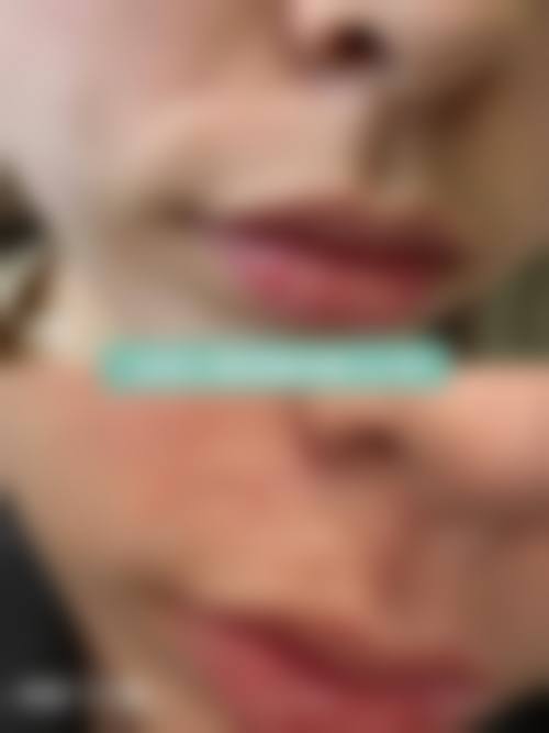 七、洛阳美莱医疗美容医院预约方式