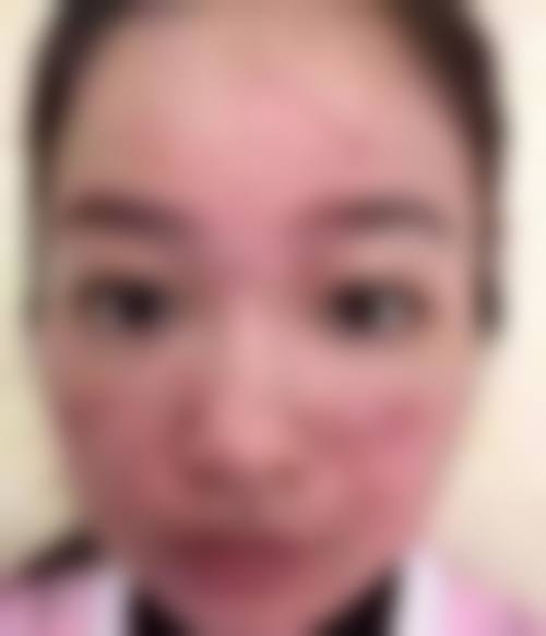 七、汕头大学医学校前列附属医院整形美容外科预约方式