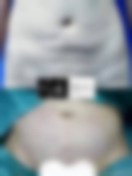 八、天津星范医疗美容门诊部真实的患者评价