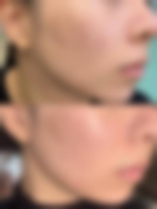 四、苏州心妍美整形医院特色项目